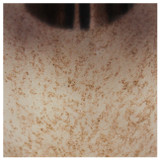 EV20925-03#26" Feist Small Urn With Topper