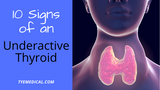 10 Signs of Hypothyroidism (Underactive Thyroid)