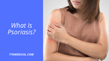 What Is Psoriasis and Can It Surface Mid-Life?