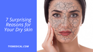 7 Surprising Reasons for Your Dry Skin