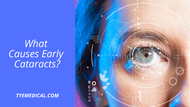 What Causes Early Cataracts?