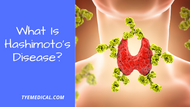 ​ What Is Hashimoto’s Disease? (And When You Should Be Concerned)