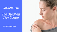 Melanoma: The Deadliest Skin Cancer