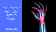 Rheumatoid Arthritis Facts to Know