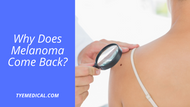 Recurrent Melanoma: Why Does It Keep Coming Back?