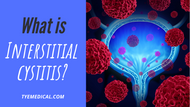 A Brief Guide to Interstitial Cystitis