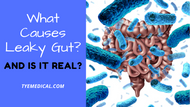 What Causes Leaky Gut (and Is It Real)?