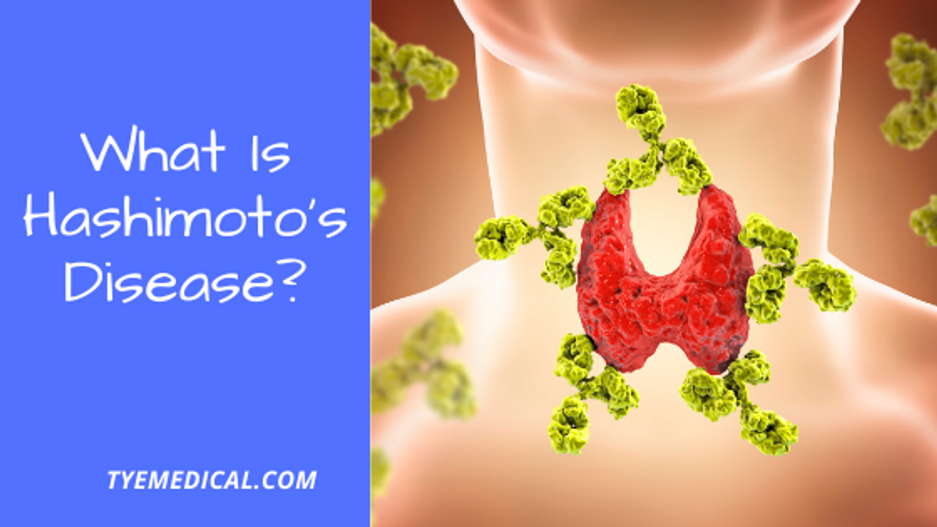 What Is Hashimotos Disease And When You Should Be Concerned Tye