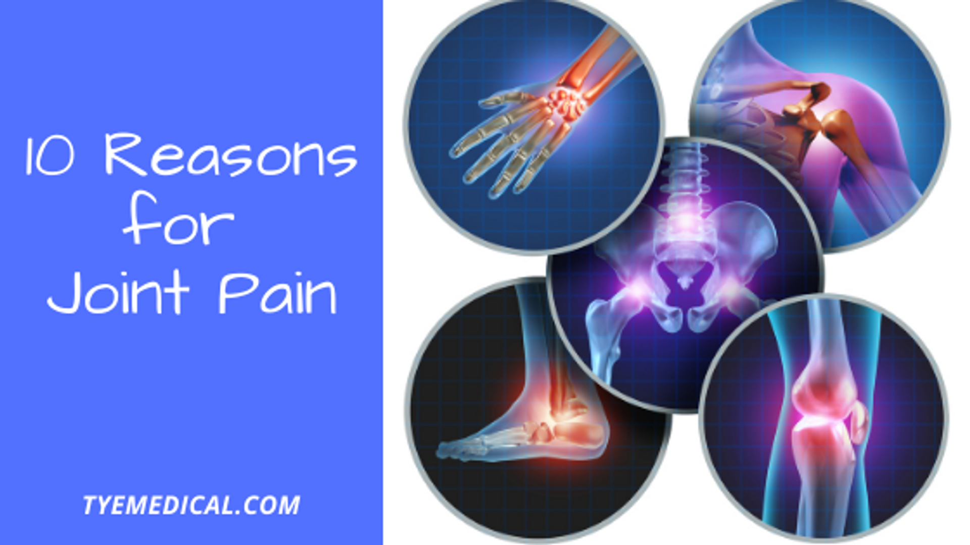 10 Possible Reasons Your Joints Hurt All the Time TYE Medical
