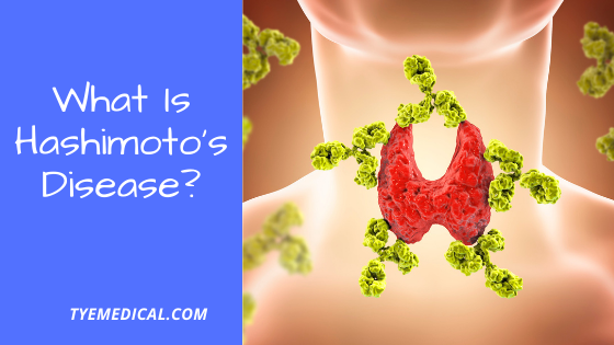 What Is Hashimoto’s Disease? (And When You Should Be Concerned) TYE