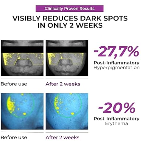 JUMISO NIACINAMIDE 20 SERUM