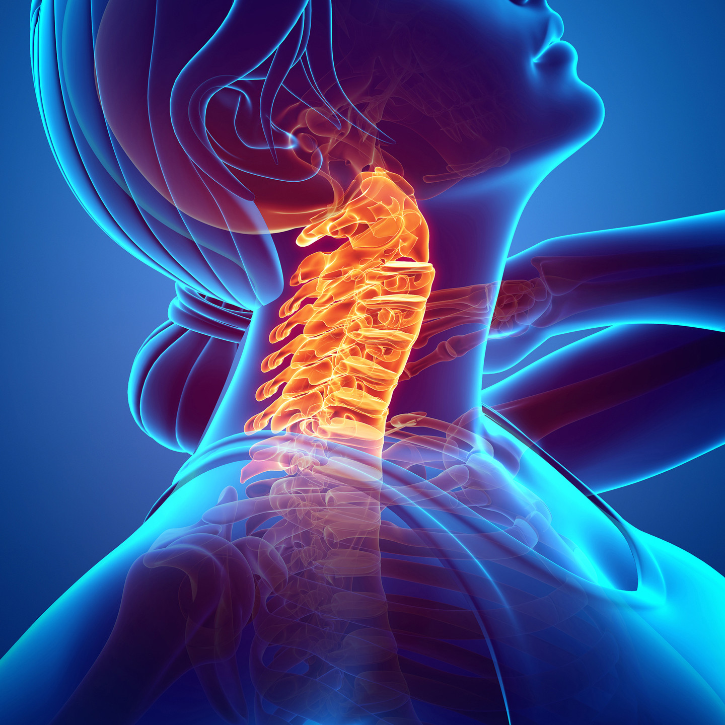 Neck Supports Neck Supports