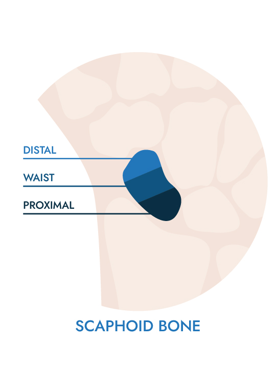 Diagram of the different sections of the scaphoid bone.