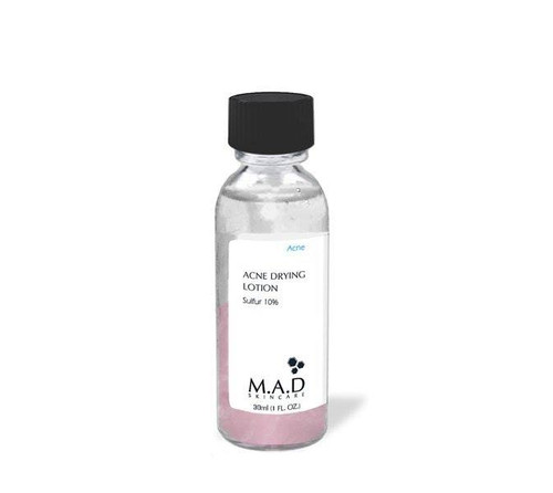 M.A.D. Skincare - Acne Drying Lotion w Sulfur 10% | LOTION TRỊ MỤN/LÀM KHÔ NHÂN MỤN

CÔNG DỤNG:
* Kem chấm mụn làm khô nhân mụn thì thị trường có khá nhiều, nhưng hãy thử loại Acne Drying Lotion w Sulfur 10% do Emma Skincare giới thiệu và bạn sẽ thấy sự khác biệt.
* Với nồng độ lưu huỳnh 10%, kem chấm mụn qua đêm Acne Drying Lotion w Sulfur 10% giúp làm khô các nốt mụn nhanh chóng, thu giảm kích cỡ mụn, giảm hẳn tình trạng sung và tấy đỏ của mụn cho ngày hôm sau có gặp người yêu vẫn không cần lo lắng nhé ;).
* Tăng cường hoạt hóa của salicylic acid giúp làm sạch các lớp tế bào chết và á sừng cứng đầu gây mụn đầu đen và hình thành nhân mụn do bít lỗ chân lông, giúp công cuộc tiêu diệt khuẩn mụn diễn ra nhanh hơn và tránh sẹo hình thành sau này cho da của bạn.
* Chứa chiết xuất từ cây long não giúp làm mát và dịu lại các vết sung tấy do mụn, giảm ngứa rát do khuẩn mụn tấn công, giảm tình trạng nhạy cảm da do mụn.
* Sản phẩm không chứa chất tạo màu và paraben, an toàn cho mọi loại da.