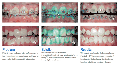 plaque hd disclosing toothpaste