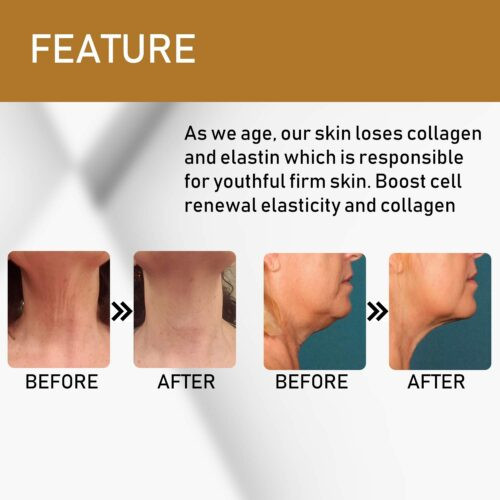 Neck Firming Double Chin Reducer Cream