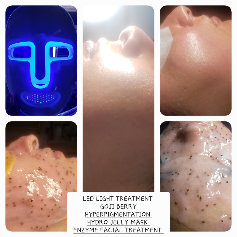 LED LIGHT TREATMENT GOJI BERRY HYPERPIGMENTATION HYDRO JELLY MASK ENZYME FACIAL TREATMENT LED LIGHT TREATMENT GOJI BERRY HYPERPIGMENTATION HYDRO JELLY MASK ENZYME FACIAL TREATMENT