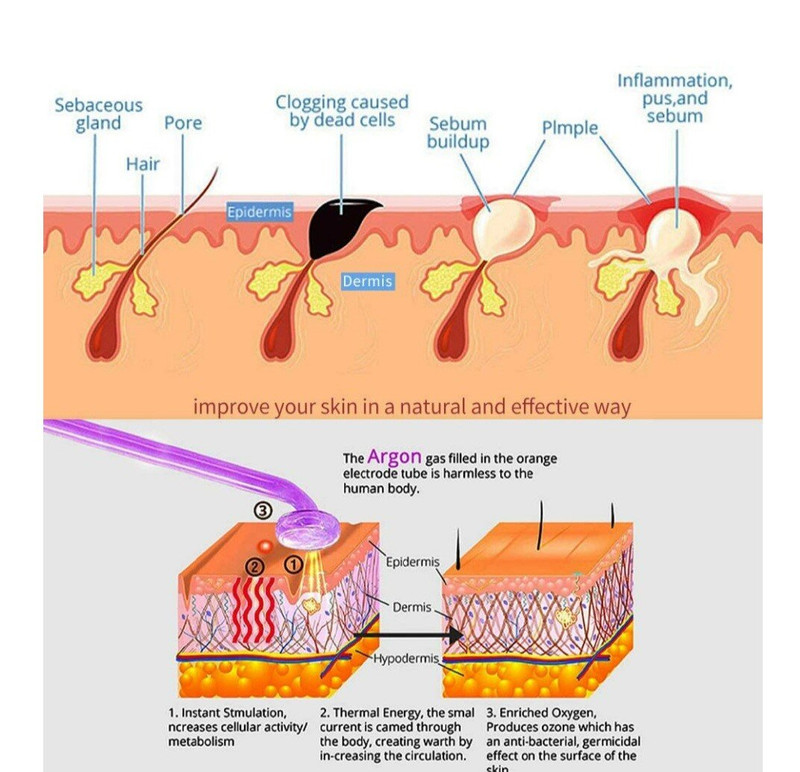 Understanding Skin Layers Understanding Skin Layers