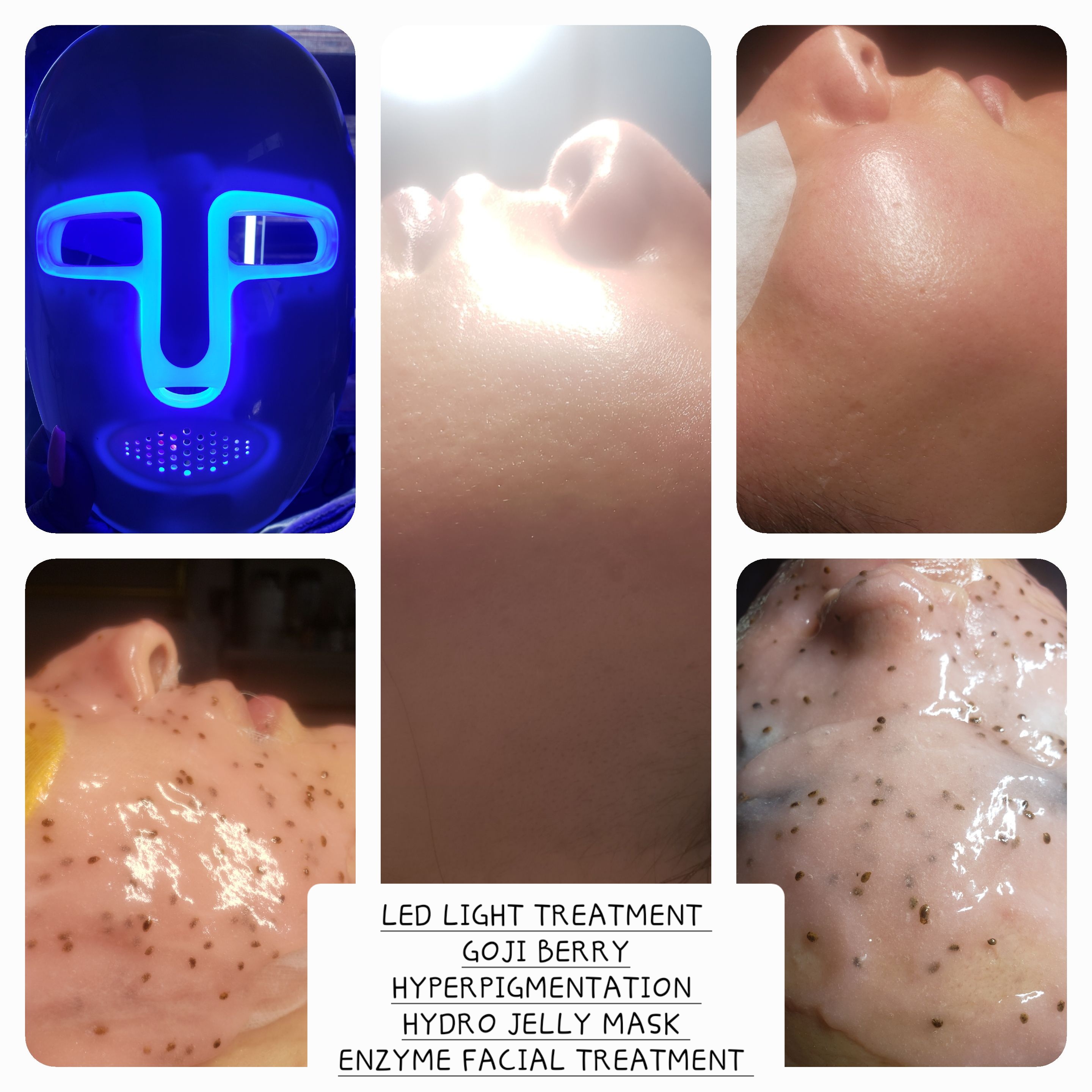 LED LIGHT TREATMENT GOJI BERRY HYPERPIGMENTATION HYDRO JELLY MASK ENZYME FACIAL TREATMENT