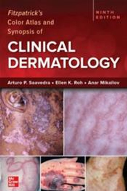 Fitzpatrick's Color Atlas and Synopsis of Clinical Dermatology 9/e