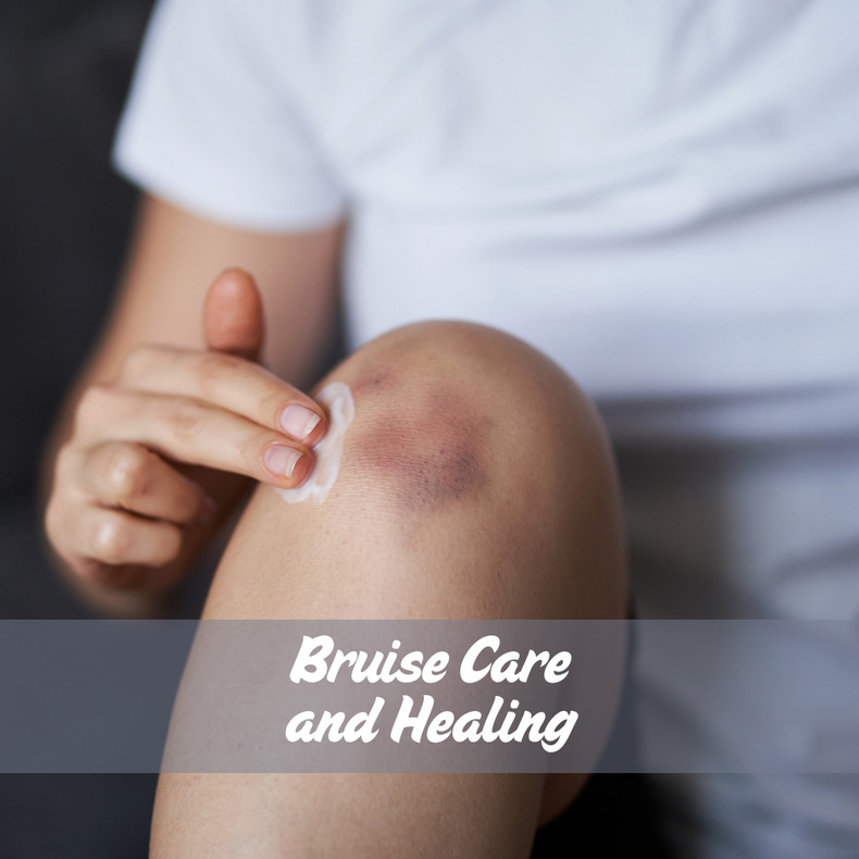 Tips for Effective Bruise Care and Healing