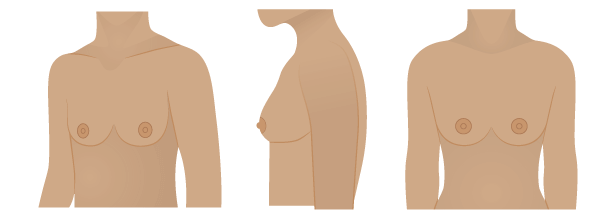 Types of Boobs, Boob Shapes