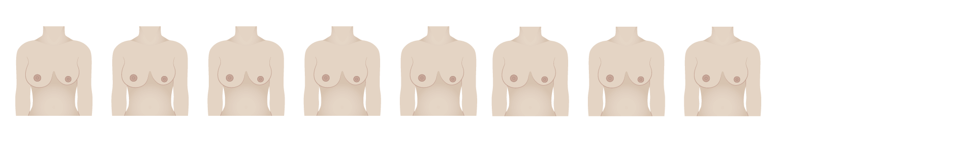 Breast Shape Results