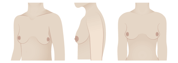 Types of Boobs, Boob Shapes