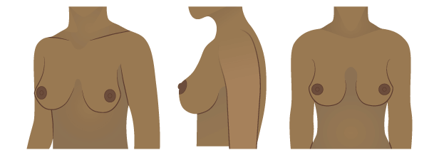 Can you identify your breast shape? #shyawayshop #breastshapes