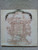 Nitty Gritty Dirt Band - Dirt, Silver & Gold (3xLP, Comp, Ter)