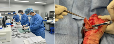 Why Burn Centers Are Switching to Single-Use Sterile Prep Blades 