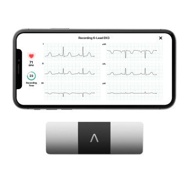 EKG Monitor with 6 Leads | KardiaMobile 6L by AliveCor EKG Monitor with 6 Leads | KardiaMobile 6L by AliveCor