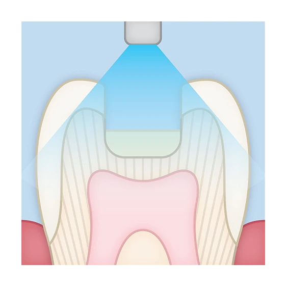 theracem sandwich tech 3
