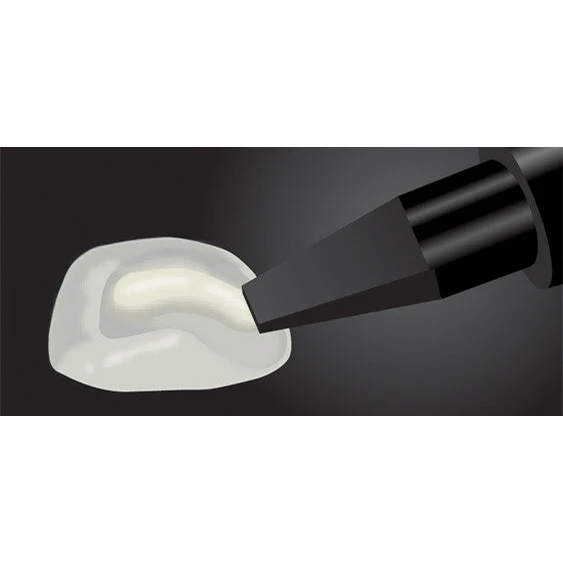 veneer-cementation step 9
