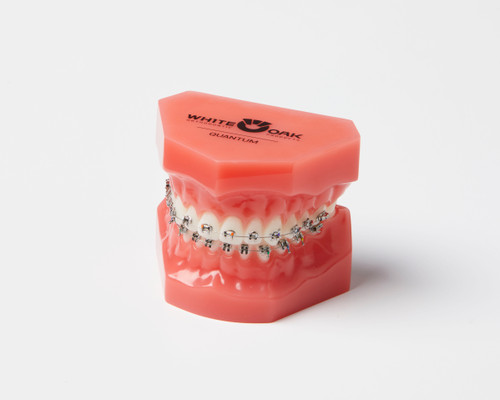 Dental Orthodontic Treatment Model (Metallic/Ceramic) Brackets –  Plutusdental