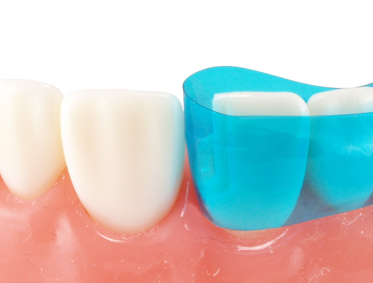 Dental Matrix System Bandes Matrices Dentaires Varistrip Vue Bleue