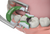 Composi-Tight® 3D Fusion™ Green Ring