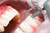 Intensiv Ortho-Strips System Coarse Brown 60µm CentralRight-Sided