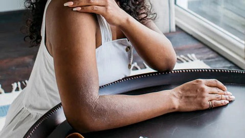 Living with Eczema: Grace, Ritual & Everyday Resilience