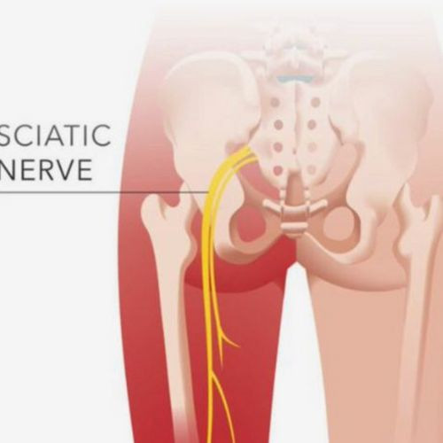 MYOFASCIAL RELEASE & SCIATICA AND MASSAGE DUO (13 CEUS)