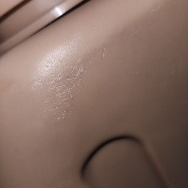 scratches on grade 1 from storage marks near the cap