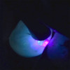 Microlux DW Transilluminator | Differentiate restorative/composite from natural tooth structure.