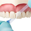 7520410 | Butterfly Matrix 60/Pack | The hands-free 100% silicone strip and wedge combination separates, protects, and isolates adjacent teeth.