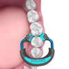 Garrison® Dental Solutions Quad Rings Short 2/Pack | Simultaneously restore both sides of adjacent Class IIs using two matrix bands, one Quad Wedge, and one Quad Ring.
