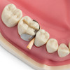 SeptoWedges 100/Pack
