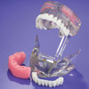 4112178 | Our exclusive Dual Arch Implant Model from MDO demonstrates two implant-supported fixed bridges.