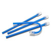 7019116 | Total-Comfort™ ColorFlex™ Saliva Ejectors 100/Pack | Blue