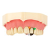 Unica Intro Kit Anterior | Ideal for Class III, IV, or V restorations, veneers, and shape modifications.