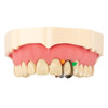 7076491 | Unica Anterior Matrices are uniquely contoured to adapt to different anterior teeth morphologies.