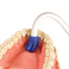 7024910 | Total-Comfort™ soft tip Ejectors offer gentle, patient-friendly design.